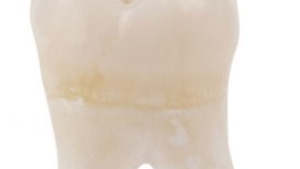 Il CercaFilm: il dentista e l’aiutante