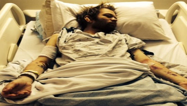 Sum 41, il cantante in ospedale con il fegato spappolato