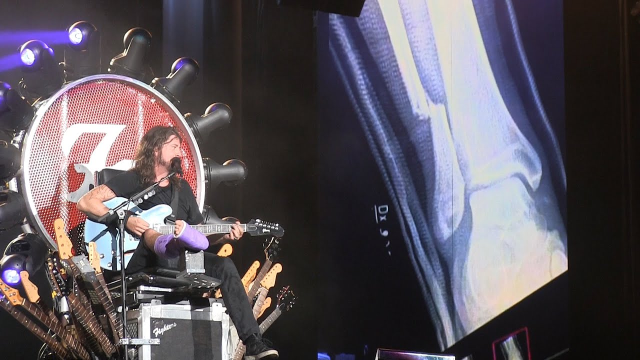 Foo Fighters 20th Anniversary Blowout- “Big Me” *Dave Tells Story of His Broken Leg* on July 4, 2015