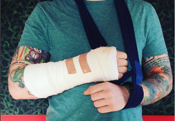 Ed Sheeran, braccio rotto per un incidente
