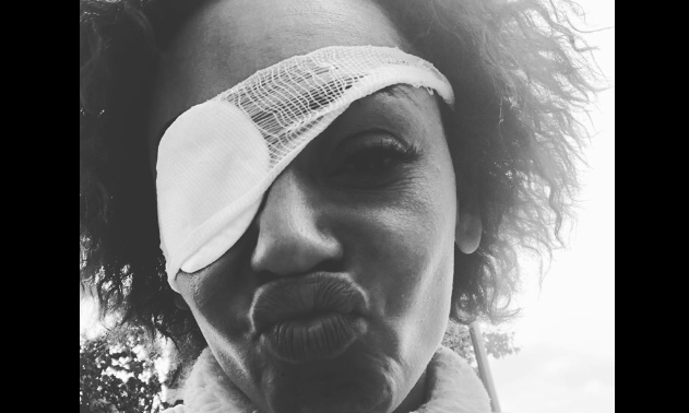 Melanie B svela cosa le è accaduto all’occhio destro (e parla del tour con le Spice Girls)