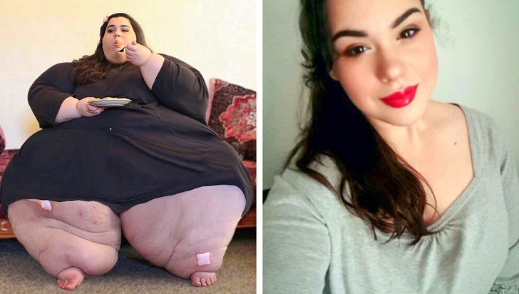 Vite al limite: com’è nato il programma e le trasformazioni di tre donne da quasi 300kg