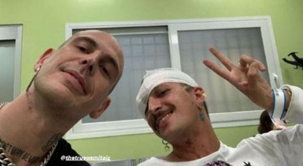 Gemitaiz e Venerus, incidente in auto: “Un fan ci è entrato dentro la macchina…”