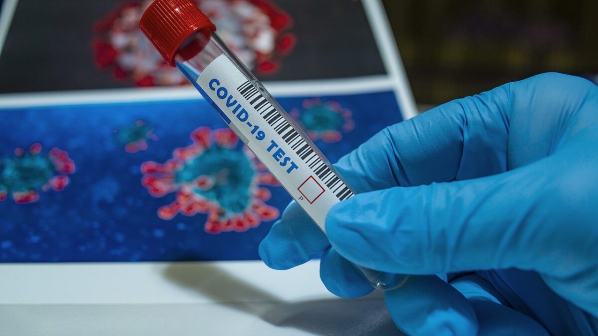 Il coronavirus resiste 28 giorni sulle superfici? Non è detto