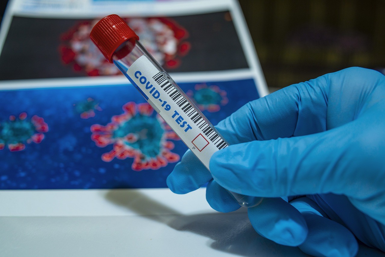 Il coronavirus resiste 28 giorni sulle superfici? Non è detto