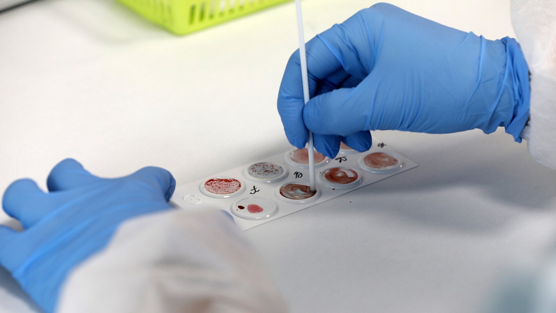 SarsCoV2 in Italia già a settembre 2019? I dubbi degli scienziati