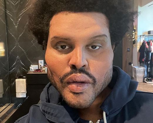 The Weeknd, la chirurgia plastica nel video “Save your tears”? I social credono siano un riferimento all’ex fidanzata