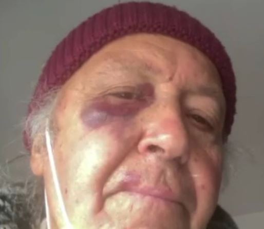 Syria, il padre picchiato per aver chiesto ad un signore di indossare la mascherina