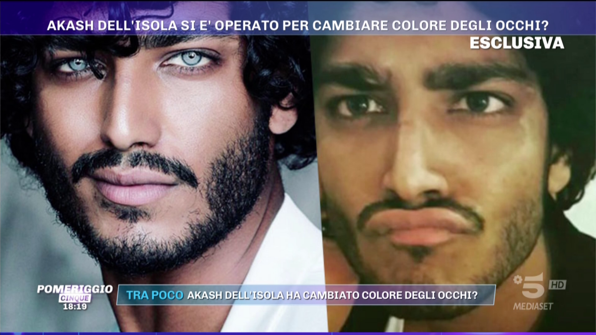 Isola dei Famosi 2021, il caso Akash Kumar: il giallo sull’identità e l’ipotesi dell’intervento agli occhi
