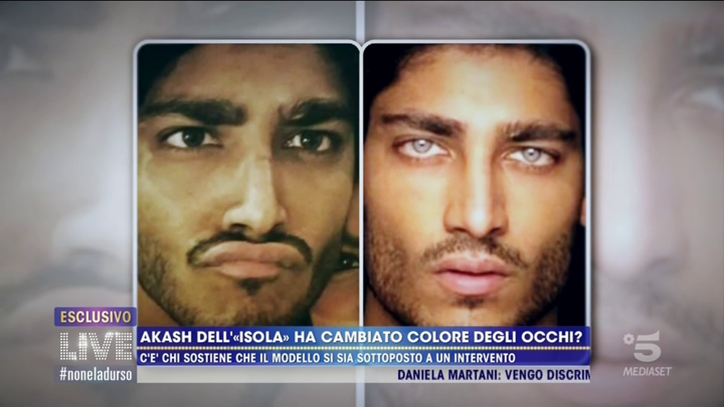 Live non è la d’Urso, testimonianza su Akash Kumar e i suoi occhi che sarebbero “ritoccati chirurgicamente”