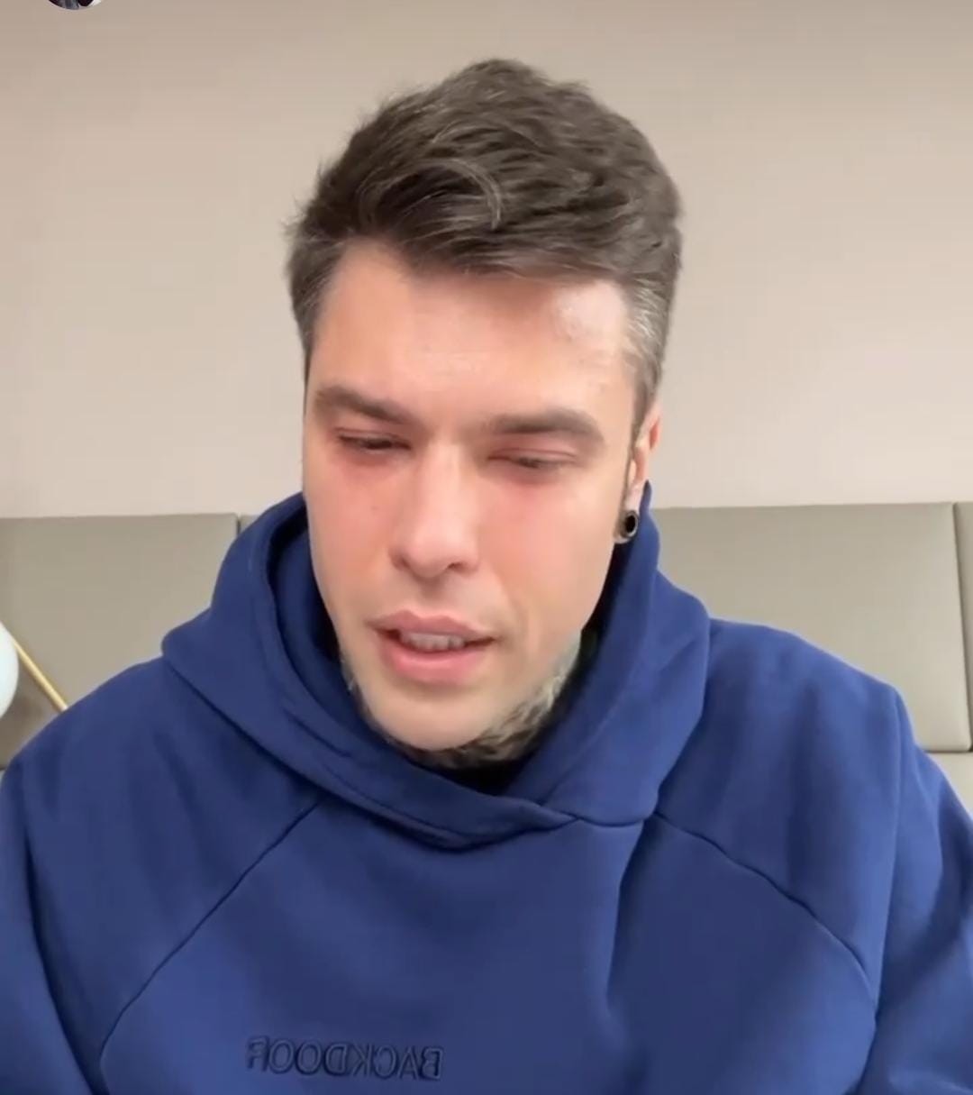 Fedez: “Purtroppo mi è stato trovato un problema di salute che comporta un percorso importante che dovrò fare”