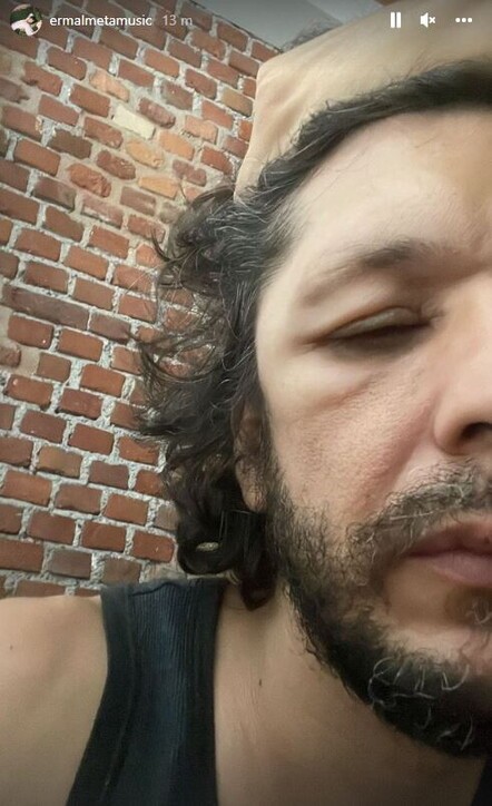 Ermal Meta