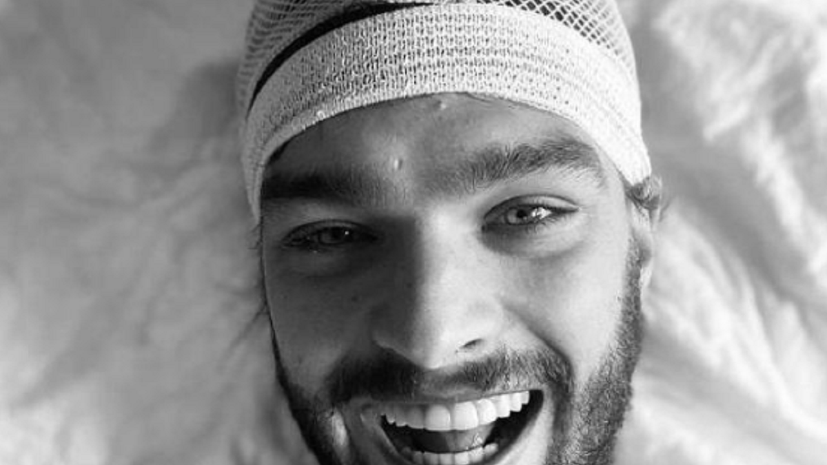 Volevo fare la rockstar, Riccardo Maria Manera ricoverato per lesione tumorale alla testa