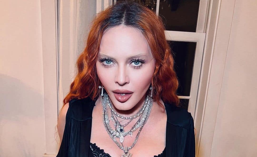 Madonna rianimata grazie ad un’iniezione di Narcan? La rivelazione