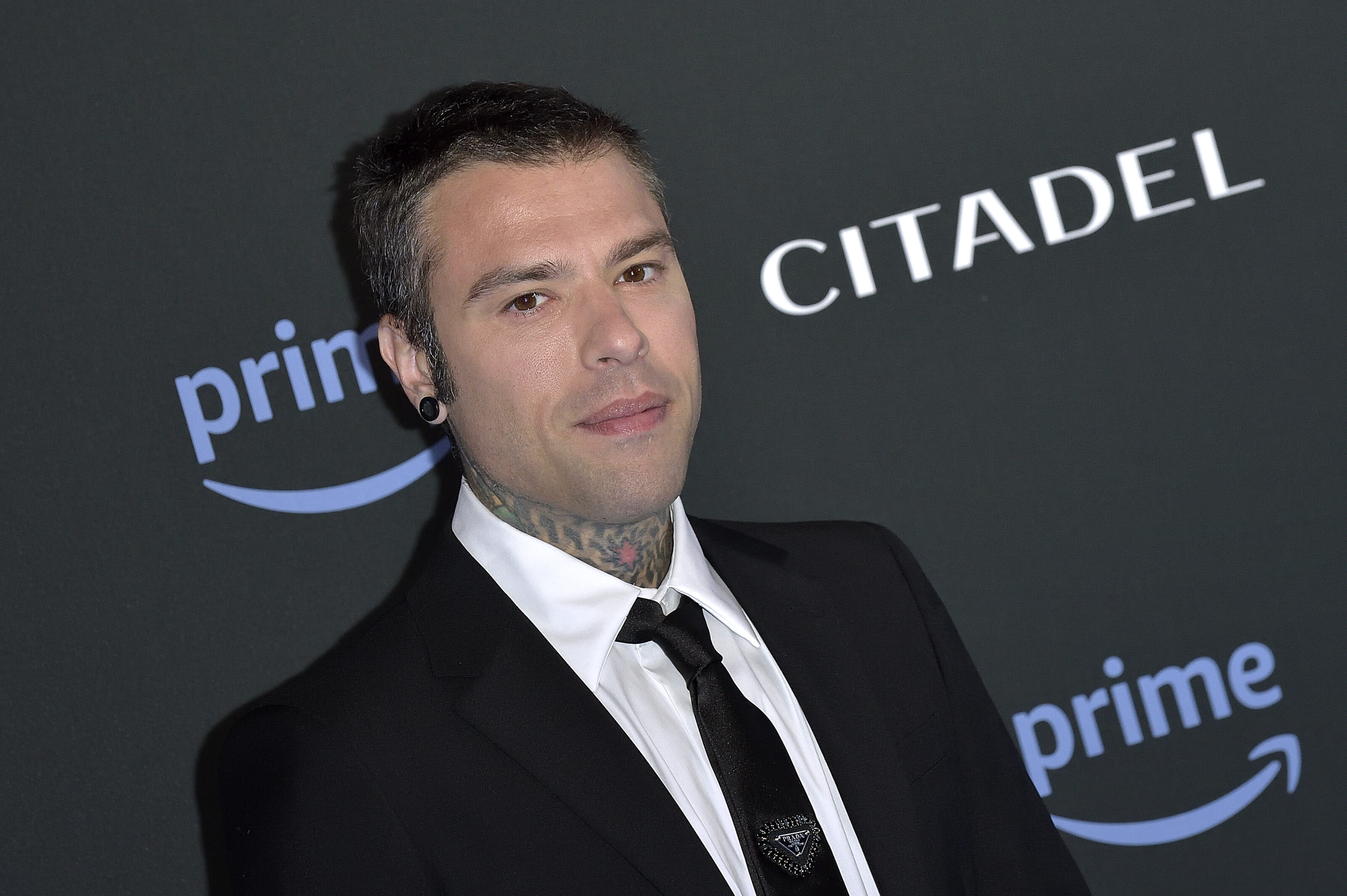 Fedez ricoverato in ospedale per un’emorragia interna: le parole del rapper