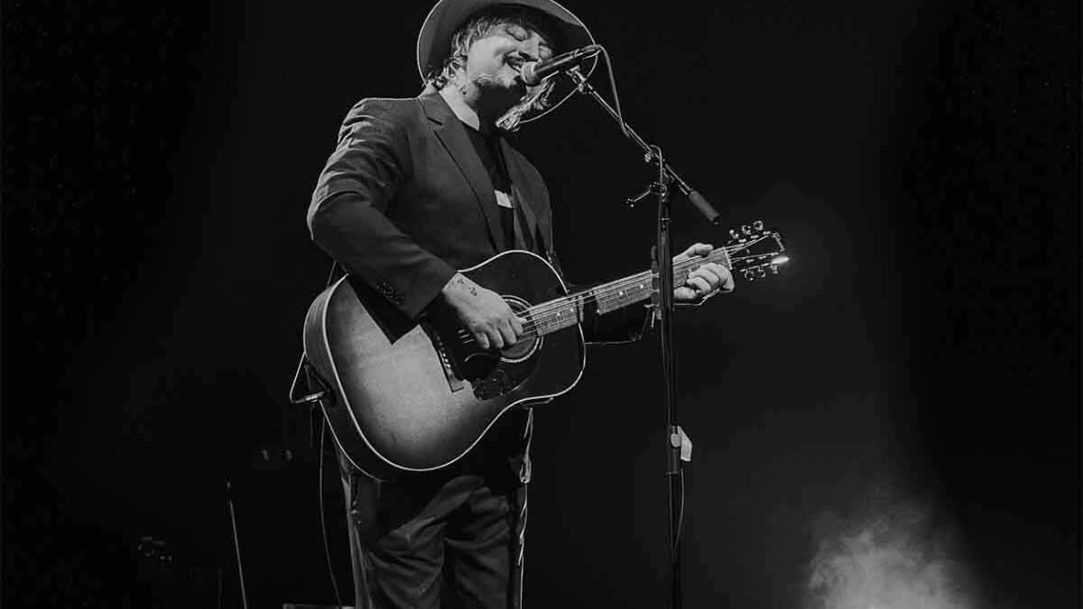 Pete Doherty parla della sua salute: “Rischio un’amputazione per colpa dell’alcol”