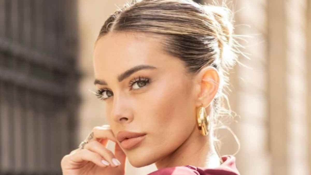 Sophie Codegoni cancella il ritocchino alle labbra con la ialuronidasi: cos’è davvero e perché ha fatto tanto male