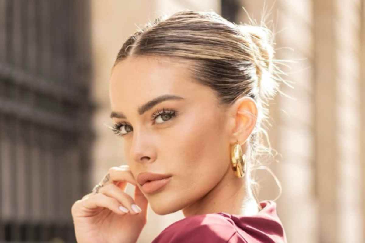 Sophie Codegoni cancella il ritocchino alle labbra con la ialuronidasi: cos’è davvero e perché ha fatto tanto male