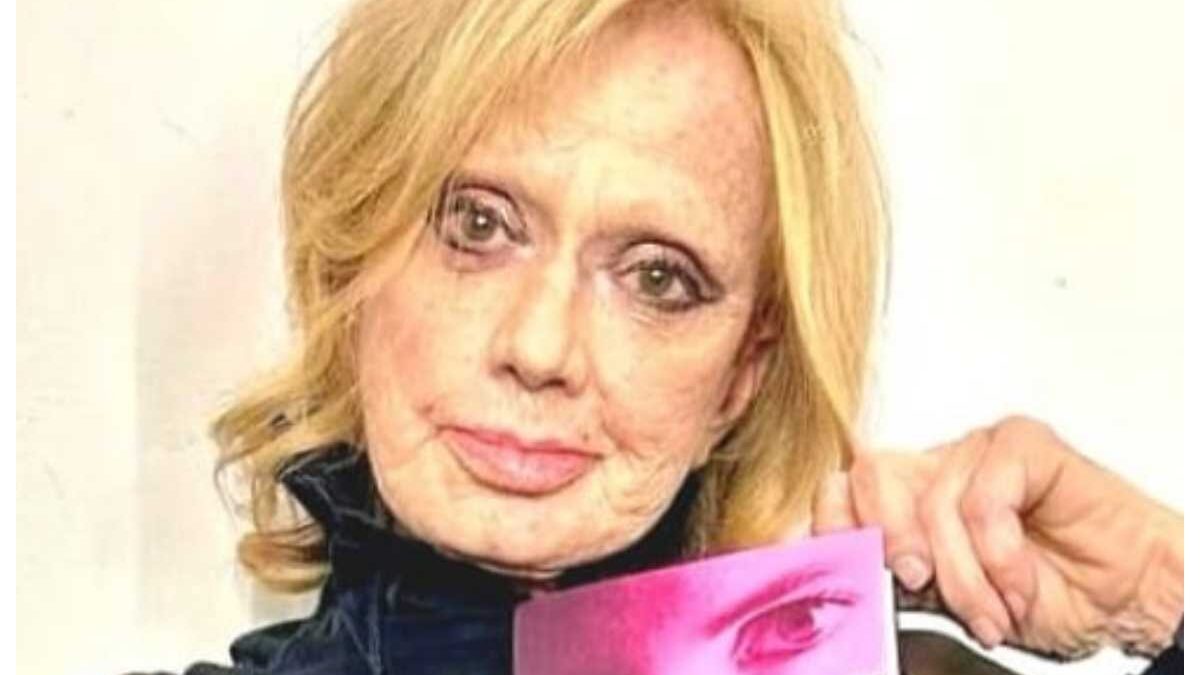 Rita Pavone: età, marito, i figli e la malattia, dove vive, la chirurgia estetica